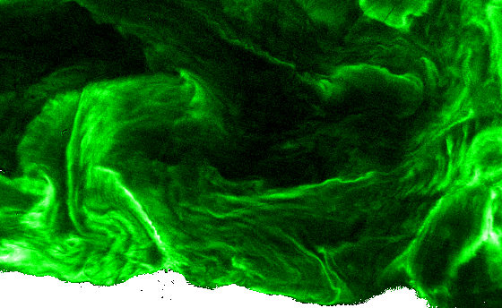Satellite-derived bloom index showing algal swirls on a lake